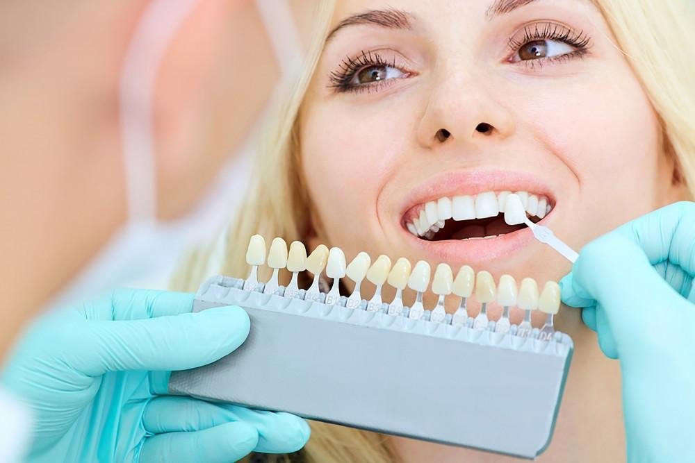 ✨ Teeth Whitening Truths: Myths, Methods, and the Safest Ways to a Brighter Smile